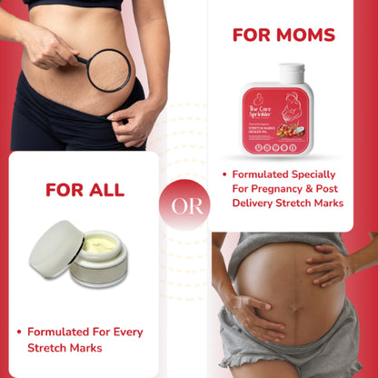 STRETCH MARKS HEALER OIL (For Moms)